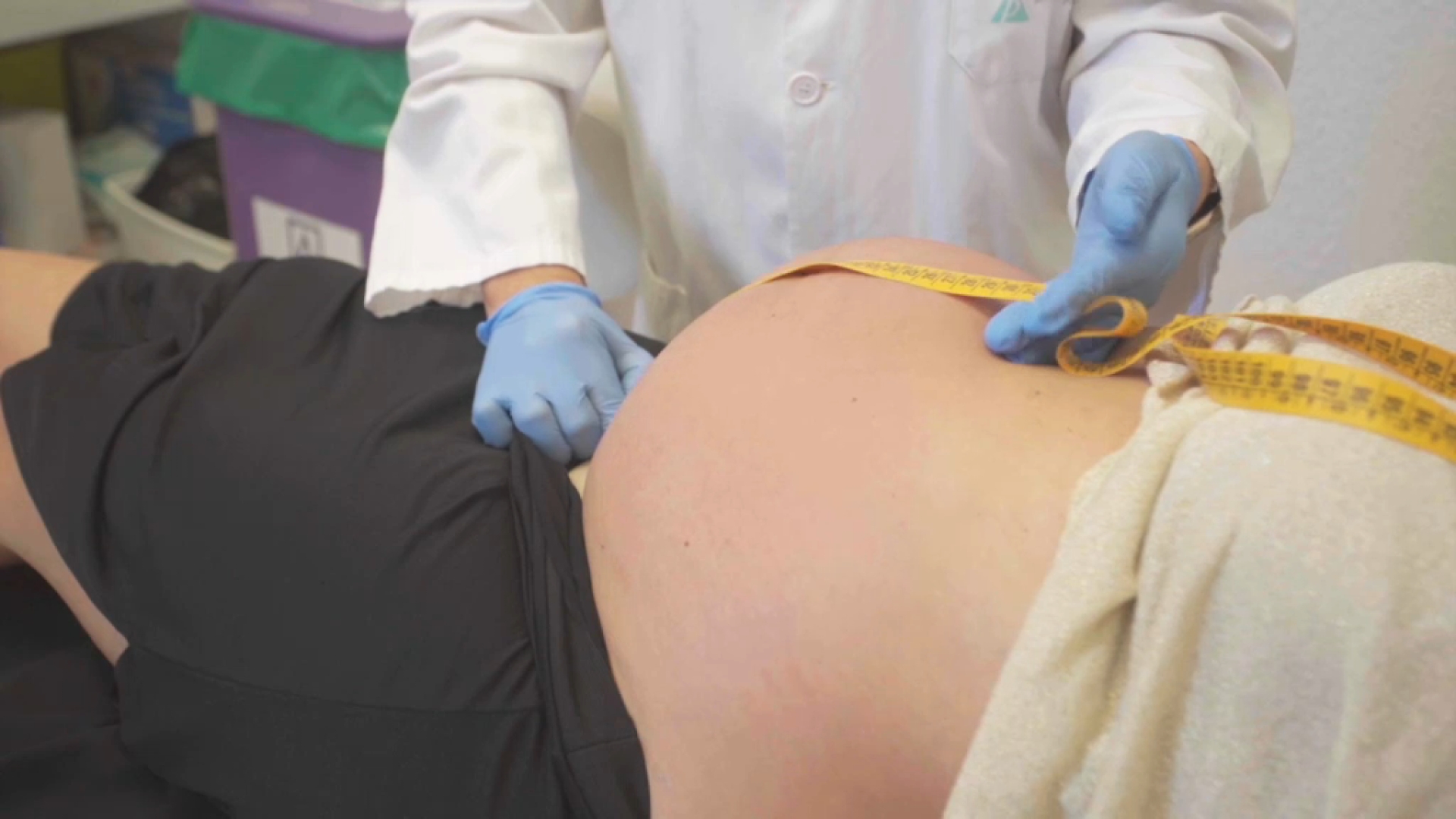 L’Hospital de Manacor derivarà dones embarassades a altres centres de Mallorca a partir de dilluns